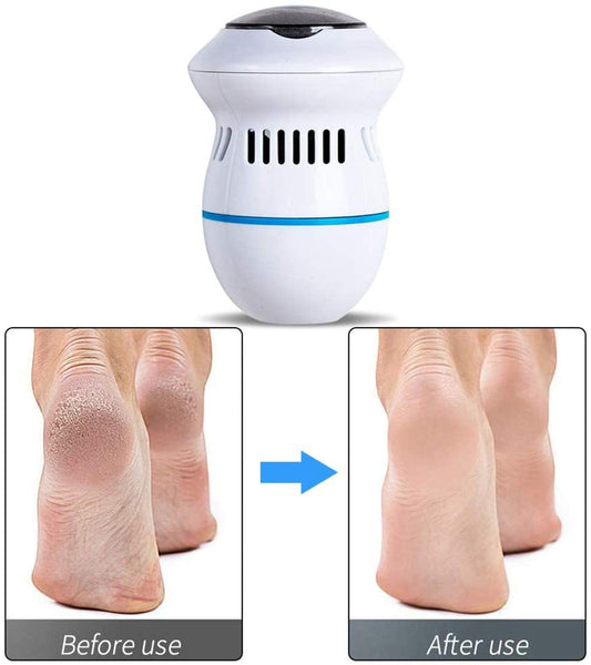 Electric Foot Grinder Vacuum Callus Remover - Prime Gift Ideas